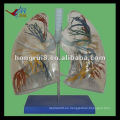 ISO Transparent Lung Segment Modelo, Human Lung HR-330